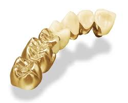 Chụp kim loại quý (86% Au)